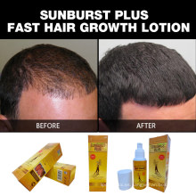Nueva actualización 100% productos genuinos para el crecimiento del cabello Sunburst Plus Loción para el crecimiento del cabello 100 ml para una rápida pérdida de cabello
